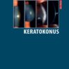 Keratokonus - Image 2