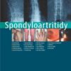Spondyloartritidy - Image 2