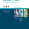 Transkatétrová implantace chlopní v instruktivních kazuistikách - Image 2