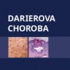 Darierova choroba - Image 2