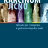 Karcinom jícnu - Průvodce pro chirurgickou a gastroenterologickou praxi - Image 2