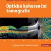 Optická koherenční tomografie - Image 2