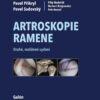 Artroskopie ramene - Image 2