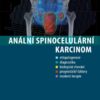 Anální spinocelulární karcinom - Image 2