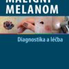 Maligní melanom - Diagnostika a léčba - Image 2