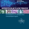 Intersticiální plicní procesy - Image 2