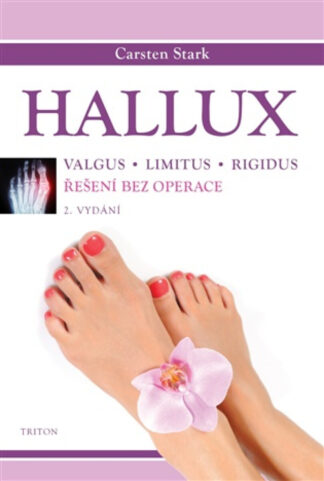 Hallux - Řešení bez operace